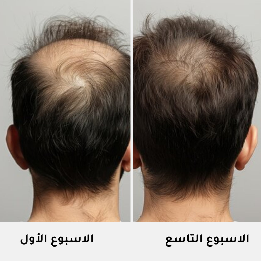 Serum Intense Cheveux Homme - 50ml