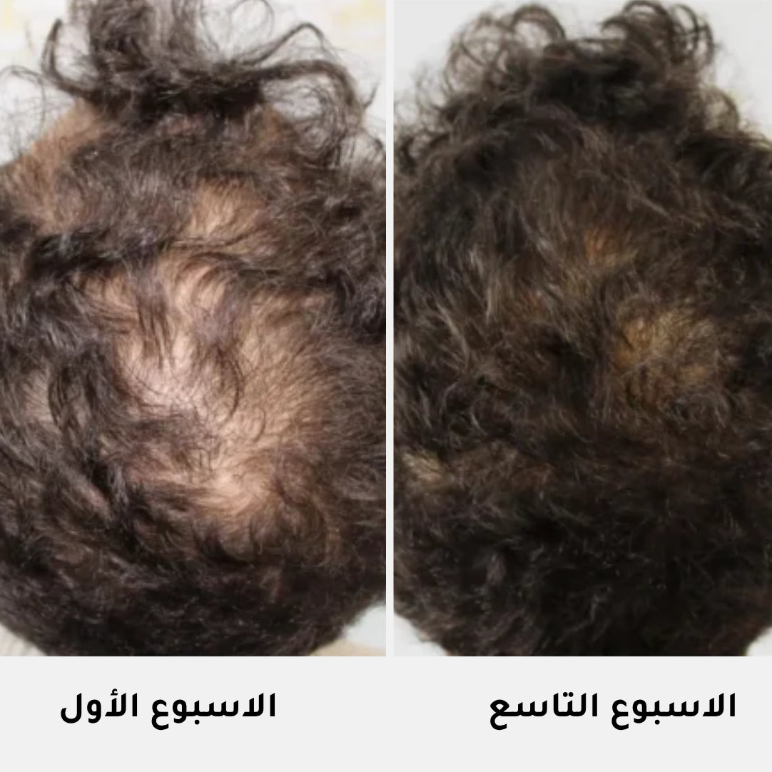 Serum Intense Cheveux Homme - 50ml