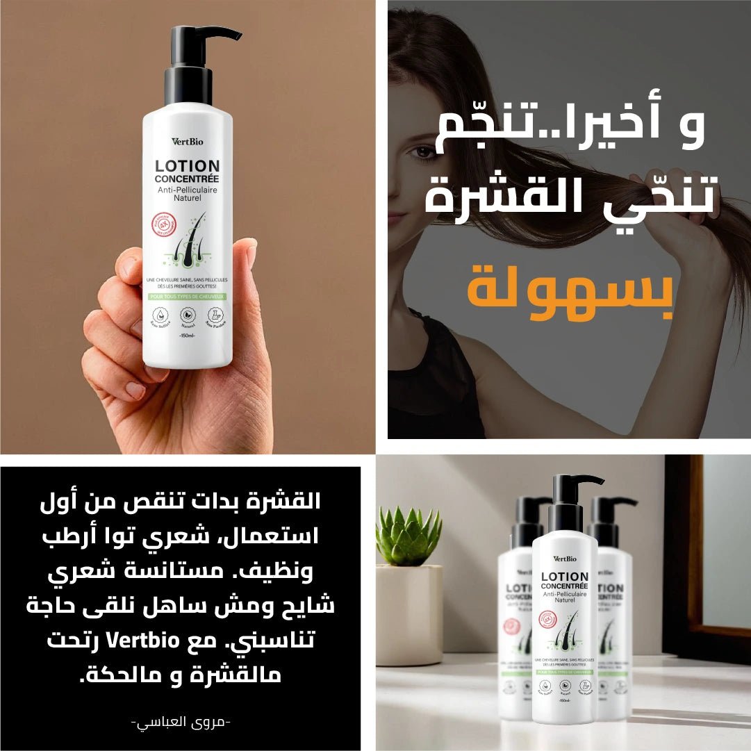 Lotion Concentrée Antipelliculaire - 150ml