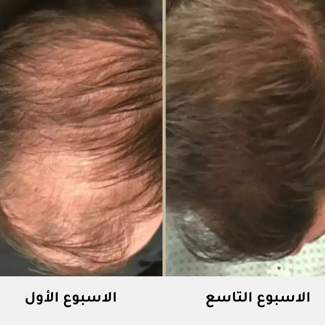 Serum Intense Cheveux Homme - 50ml