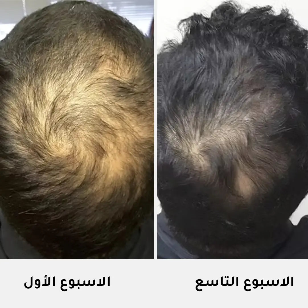 Serum Intense Cheveux Homme - 50ml